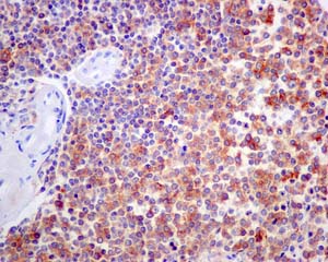 Immunohistochemistry (Formalin/PFA-fixed paraffin-embedded sections) - Anti-CD1b antibody [EP7251] (AB173576), expandable thumbnail