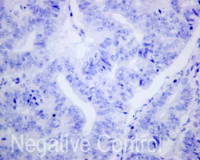 Immunohistochemistry (Formalin/PFA-fixed paraffin-embedded sections) - Anti-CD1b antibody [EP7251] (ab173576), expandable thumbnail