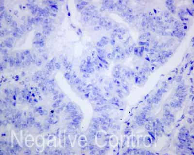 Immunohistochemistry (Formalin/PFA-fixed paraffin-embedded sections) - Anti-CD1b antibody [EP7251] (AB173576)