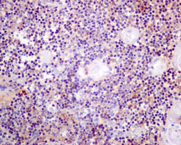 Immunohistochemistry (Formalin/PFA-fixed paraffin-embedded sections) - Anti-CD1b antibody [EP7251] - BSA and Azide free (AB284822)