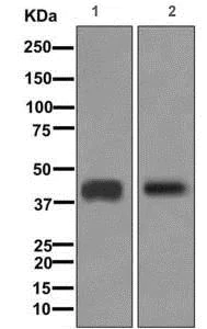 Western blot - Anti-CD1b antibody [EP7251] - BSA and Azide free (AB284822)