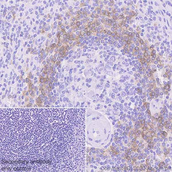 Immunohistochemistry (Formalin/PFA-fixed paraffin-embedded sections) - Anti-CD1c antibody [EPR23189-196] (AB246520), expandable thumbnail