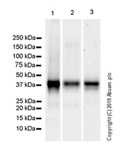 Western blot - Anti-CD1c antibody [EPR23189-196] (AB246520), expandable thumbnail