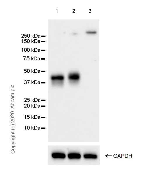 Western blot - Anti-CD1c antibody [EPR23189-196] (AB246520)