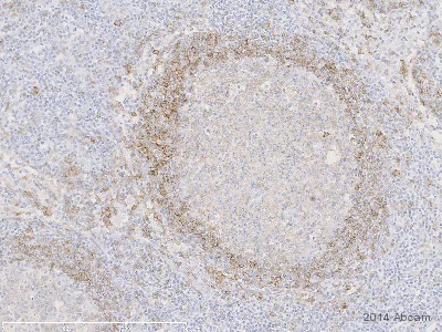 Immunohistochemistry (Formalin/PFA-fixed paraffin-embedded sections) - Anti-CD1c antibody [OTI2F4] (AB156708)