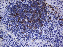 Immunohistochemistry (Formalin/PFA-fixed paraffin-embedded sections) - Anti-CD1c antibody [OTI2F4] (AB156708)