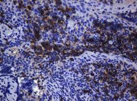 Immunohistochemistry (Formalin/PFA-fixed paraffin-embedded sections) - Anti-CD1c antibody [OTI2F4] (AB156708)
