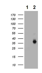 Western blot - Anti-CD1c antibody [OTI2F4] (AB156708)