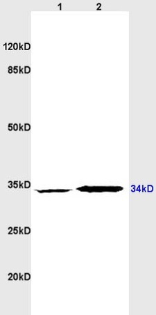 Western blot - Anti-CD1d antibody (AB215445), expandable thumbnail