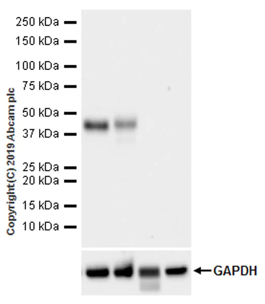 Western blot - Anti-CD1d antibody [EPR22526-9] (AB256344)