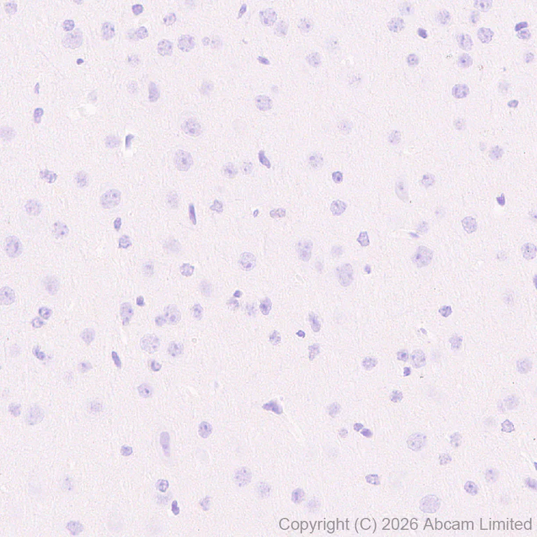 Immunohistochemistry (Formalin/PFA-fixed paraffin-embedded sections) - Anti-CD1d antibody [EPR28086-741] (AB325682)