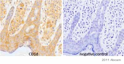 Immunohistochemistry (Formalin/PFA-fixed paraffin-embedded sections) - Anti-CD1d antibody [NOR3.2 (NOR3.2/13.17)] (AB11076), expandable thumbnail