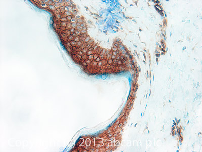 Immunohistochemistry (Formalin/PFA-fixed paraffin-embedded sections) - Anti-CD1d antibody [NOR3.2 (NOR3.2/13.17)] - BSA and Azide free (AB238657)