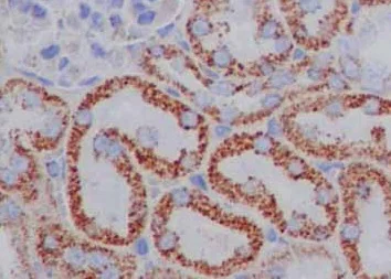 Immunohistochemistry (Formalin/PFA-fixed paraffin-embedded sections) - Anti-CD1E antibody [EPR15746(B)] (AB187157)