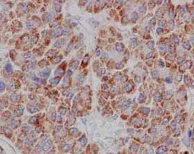 Immunohistochemistry (Formalin/PFA-fixed paraffin-embedded sections) - Anti-CD1E antibody [EPR15746(B)] - BSA and Azide free (AB250917)