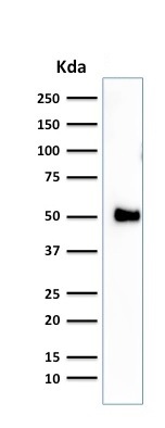 Western blot - Anti-CD2 antibody [1E7E8.G4] (AB193344), expandable thumbnail