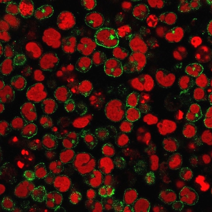 Immunocytochemistry/ Immunofluorescence - Anti-CD2 antibody [1E7E8.G4] - BSA and Azide free (AB212988), expandable thumbnail