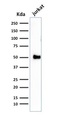 Western blot - Anti-CD2 antibody [1E7E8.G4] - BSA and Azide free (AB212988), expandable thumbnail