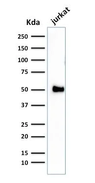 Western blot - Anti-CD2 antibody [1E7E8.G4] - BSA and Azide free (AB212988)