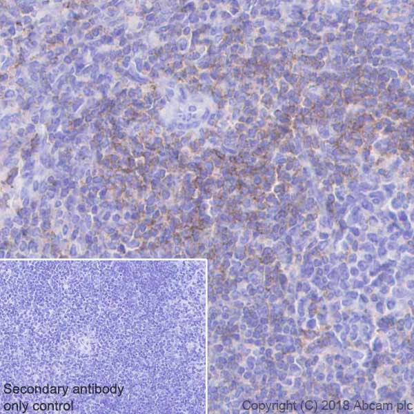 Immunohistochemistry (Formalin/PFA-fixed paraffin-embedded sections) - Anti-CD2 antibody [EPR21825] - BSA and Azide free (AB231059)