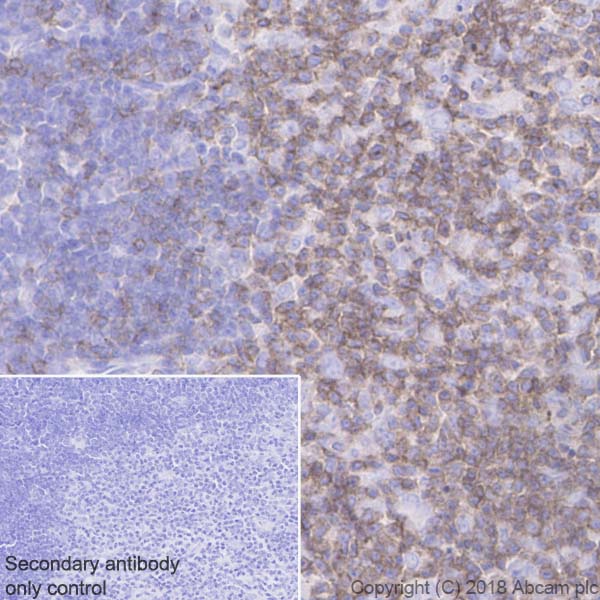 Immunohistochemistry (Formalin/PFA-fixed paraffin-embedded sections) - Anti-CD2 antibody [EPR21825] - BSA and Azide free (AB231059)