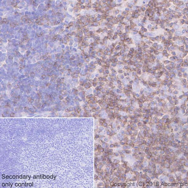 Immunohistochemistry (Formalin/PFA-fixed paraffin-embedded sections) - Anti-CD2 antibody [EPR21825] - BSA and Azide free (AB231059)