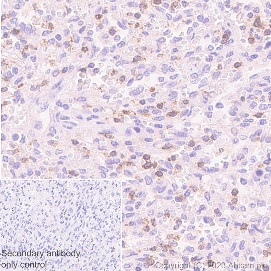 Immunohistochemistry (Formalin/PFA-fixed paraffin-embedded sections) - Anti-CD2 antibody [EPR27426-17] (ab314761), expandable thumbnail