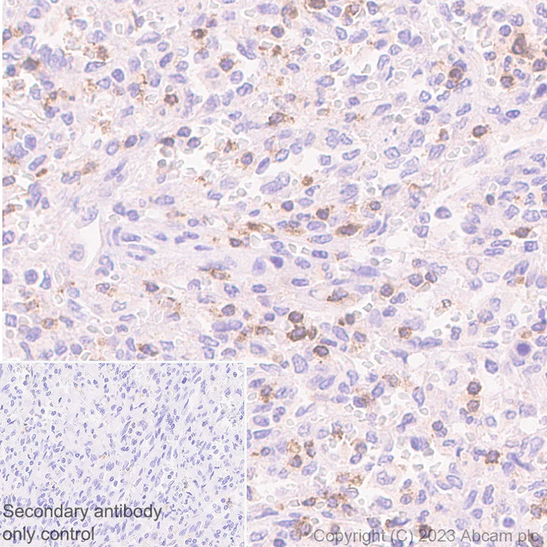 Immunohistochemistry (Formalin/PFA-fixed paraffin-embedded sections) - Anti-CD2 antibody [EPR27426-17] (AB314761)