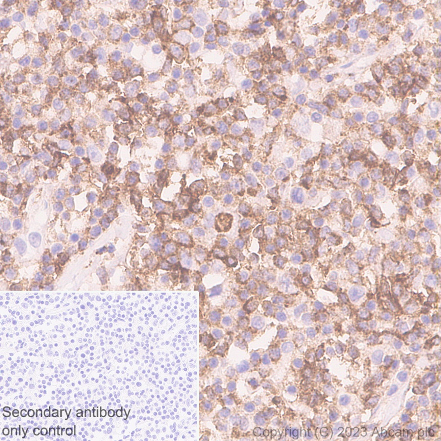 Immunohistochemistry (Formalin/PFA-fixed paraffin-embedded sections) - Anti-CD2 antibody [EPR27426-17] (ab314761), expandable thumbnail
