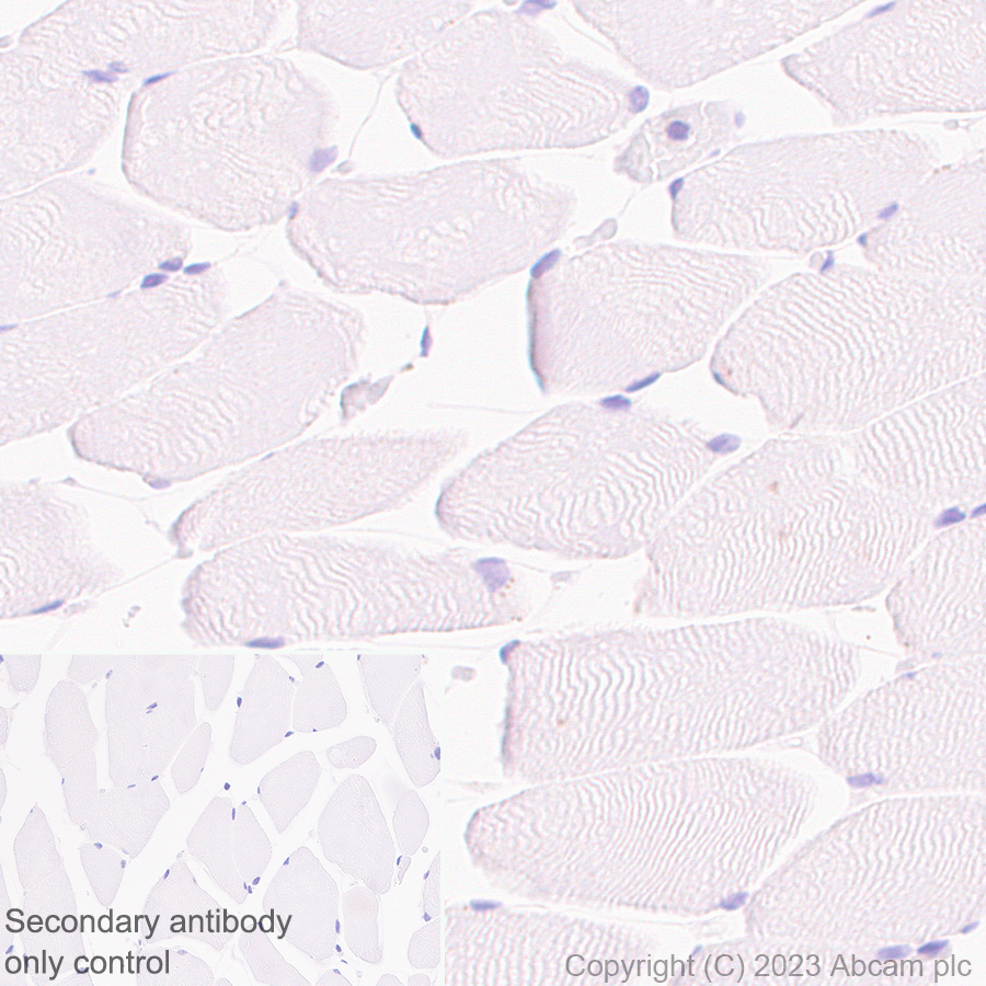 Immunohistochemistry (Formalin/PFA-fixed paraffin-embedded sections) - Anti-CD2 antibody [EPR27426-17] (ab314761), expandable thumbnail