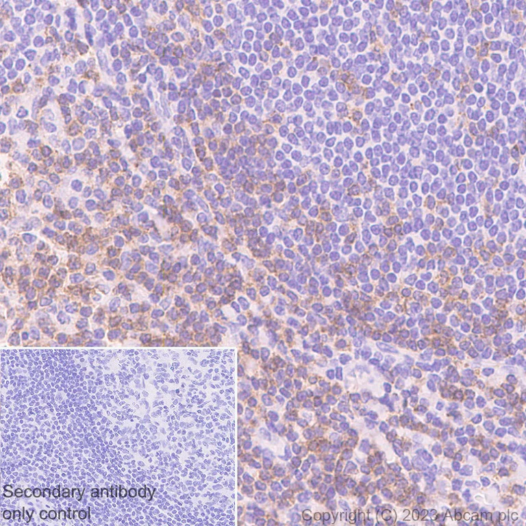 Immunohistochemistry (Formalin/PFA-fixed paraffin-embedded sections) - Anti-CD2 antibody [EPR27426-17] - BSA and Azide free (AB314762)