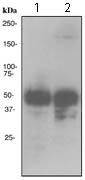 Western blot - Anti-CD2 antibody [EPR3693] (AB119993), expandable thumbnail