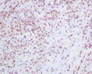 Immunohistochemistry (Formalin/PFA-fixed paraffin-embedded sections) - Anti-CD2 antibody [EPR6451] (AB131276)