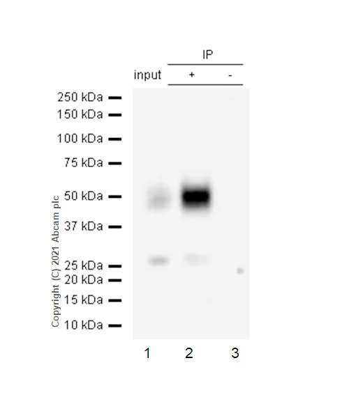 Immunoprecipitation - Anti-CD2 antibody [EPR6451] (AB131276)
