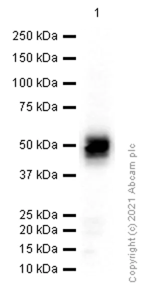 Western blot - Anti-CD2 antibody [EPR6451] (AB131276)