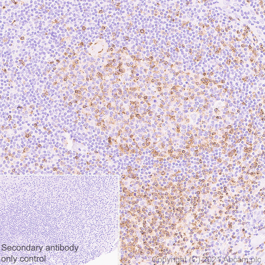 Immunohistochemistry (Formalin/PFA-fixed paraffin-embedded sections) - Anti-CD2 antibody [EPR6451] - BSA and Azide free (AB248400), expandable thumbnail