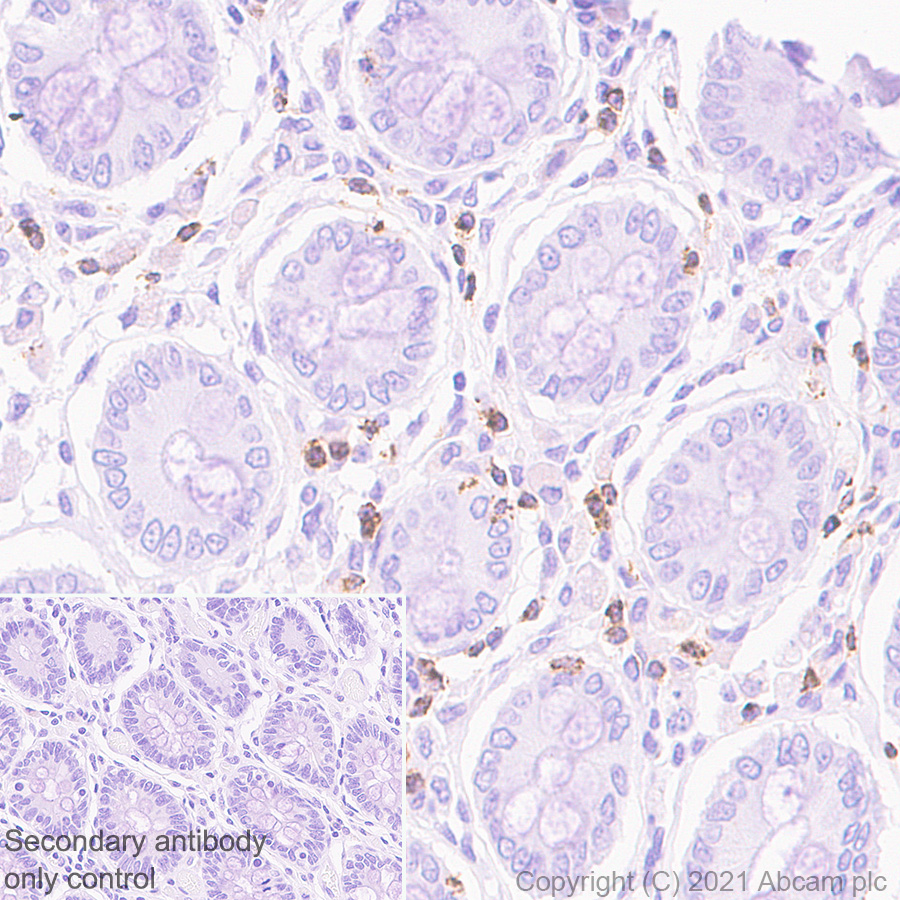 Immunohistochemistry (Formalin/PFA-fixed paraffin-embedded sections) - Anti-CD2 antibody [EPR6451] - BSA and Azide free (ab248400), expandable thumbnail