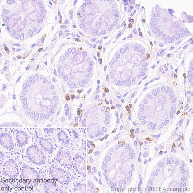 Immunohistochemistry (Formalin/PFA-fixed paraffin-embedded sections) - Anti-CD2 antibody [EPR6451] - BSA and Azide free (AB248400)