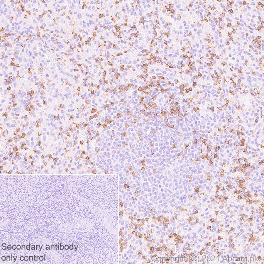 Immunohistochemistry (Formalin/PFA-fixed paraffin-embedded sections) - Anti-CD2 antibody [EPR6451] - BSA and Azide free (AB248400), expandable thumbnail