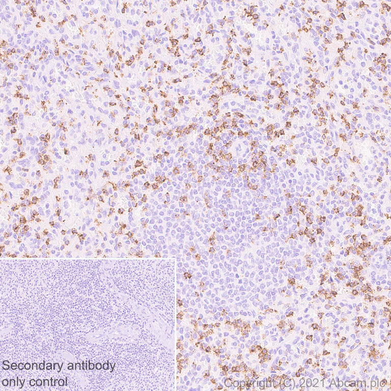 Immunohistochemistry (Formalin/PFA-fixed paraffin-embedded sections) - Anti-CD2 antibody [EPR6451] - BSA and Azide free (AB248400)