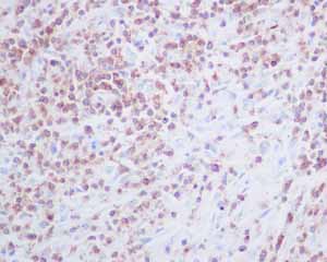 Immunohistochemistry (Formalin/PFA-fixed paraffin-embedded sections) - Anti-CD2 antibody [EPR6451] - BSA and Azide free (AB248400), expandable thumbnail