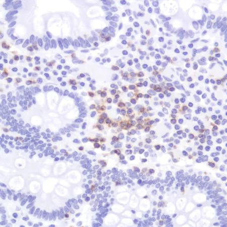 Immunohistochemistry (Formalin/PFA-fixed paraffin-embedded sections) - Anti-CD2 antibody [SP304] (AB227698)
