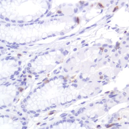 Immunohistochemistry (Formalin/PFA-fixed paraffin-embedded sections) - Anti-CD2 antibody [SP304] (AB227698)
