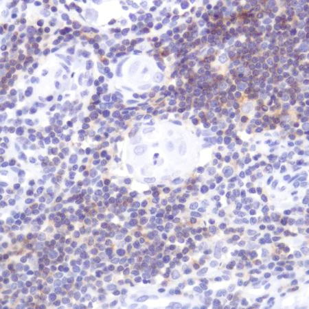 Immunohistochemistry (Formalin/PFA-fixed paraffin-embedded sections) - Anti-CD2 antibody [SP304] (AB227698)
