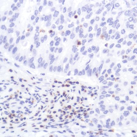 Immunohistochemistry (Formalin/PFA-fixed paraffin-embedded sections) - Anti-CD2 antibody [SP304] - BSA and Azide free (ab272017), expandable thumbnail
