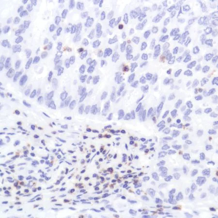 Immunohistochemistry (Formalin/PFA-fixed paraffin-embedded sections) - Anti-CD2 antibody [SP304] - BSA and Azide free (AB272017)