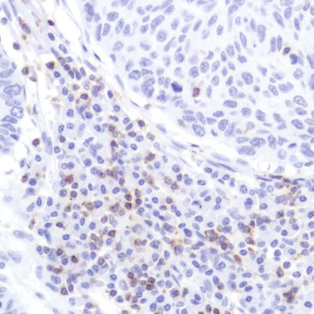 Immunohistochemistry (Formalin/PFA-fixed paraffin-embedded sections) - Anti-CD2 antibody [SP304] - BSA and Azide free (AB272017)