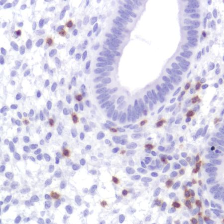 Immunohistochemistry (Formalin/PFA-fixed paraffin-embedded sections) - Anti-CD2 antibody [SP304] - BSA and Azide free (ab272017), expandable thumbnail