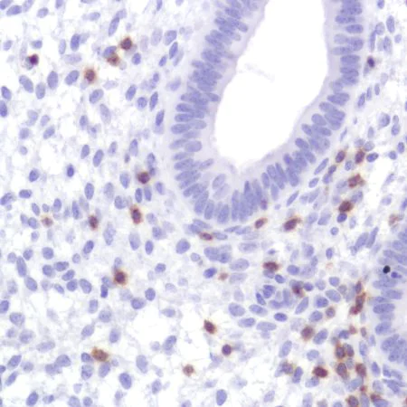 Immunohistochemistry (Formalin/PFA-fixed paraffin-embedded sections) - Anti-CD2 antibody [SP304] - BSA and Azide free (AB272017)