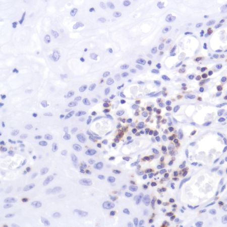 Immunohistochemistry (Formalin/PFA-fixed paraffin-embedded sections) - Anti-CD2 antibody [SP304] - BSA and Azide free (ab272017), expandable thumbnail